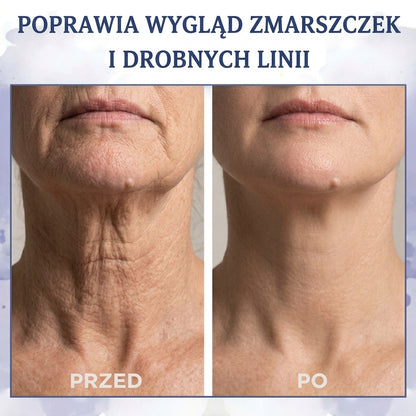 Firmora |  Krem ujędrniający i redukujący zmarszczki