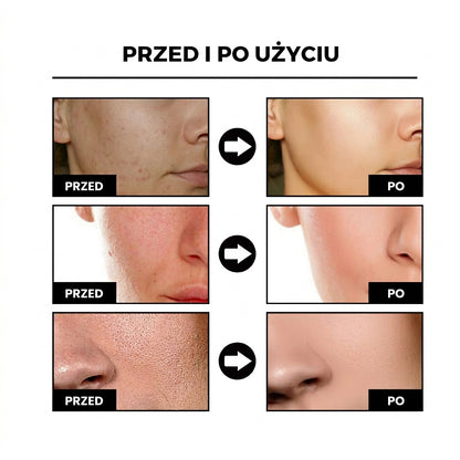PoreLisse |  Serum wygładzające skórę