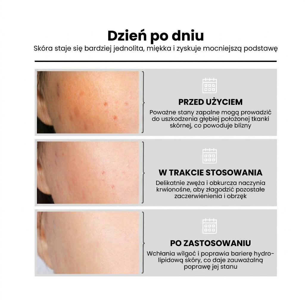 PoreLisse |  Serum wygładzające skórę