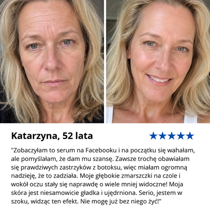 Ceralisse | Serum z botoksem