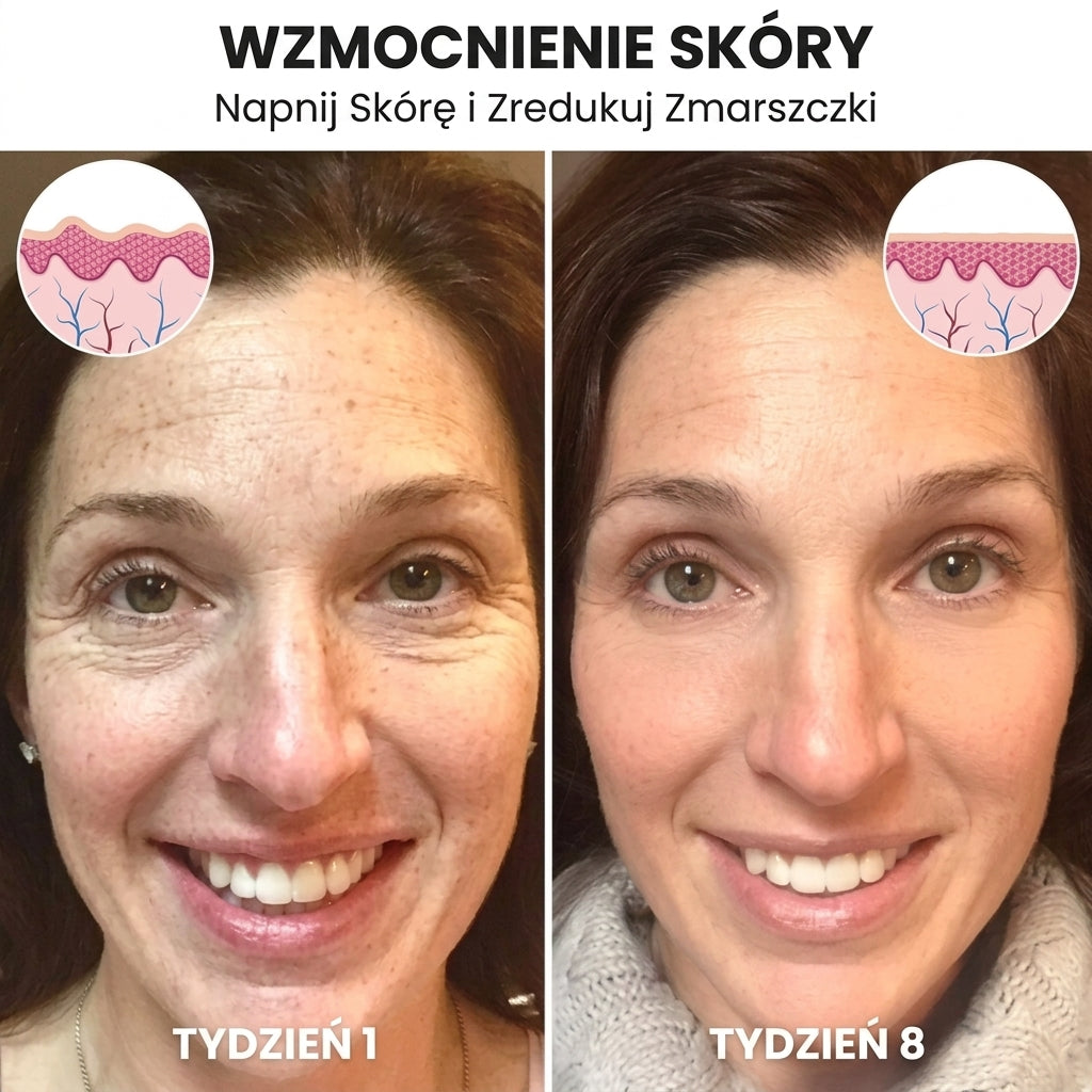 LiftAge |  Serum do twarzy z botoksem