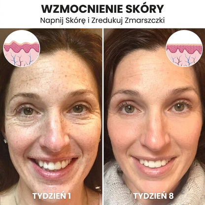 LiftAge |  Serum do twarzy z botoksem