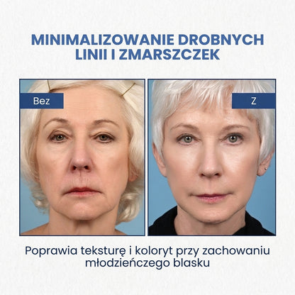 LiftAge |  Serum do twarzy z botoksem