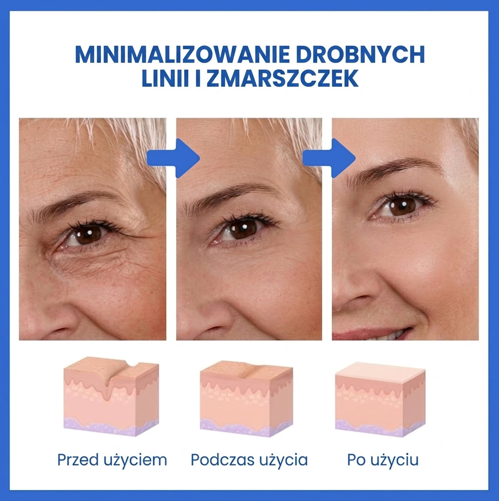 LiftAge |  Serum do twarzy z botoksem