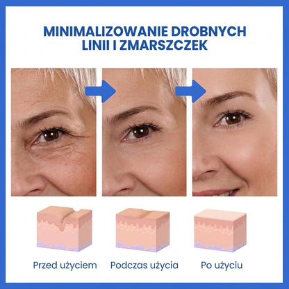 LiftAge |  Serum do twarzy z botoksem