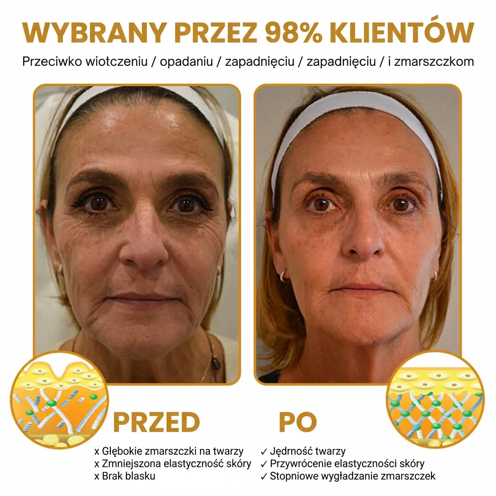 Ceralisse | Krem do usuwania zmarszczek z efektem botoksu