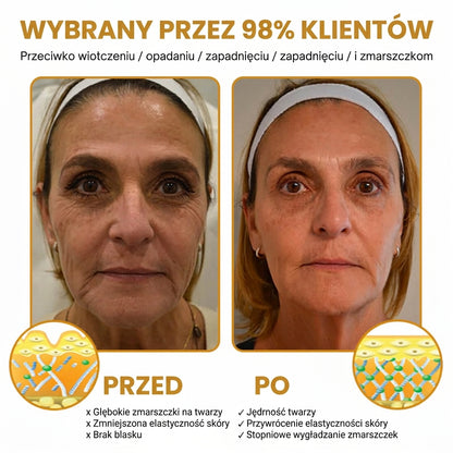 Ceralisse | Krem do usuwania zmarszczek z efektem botoksu